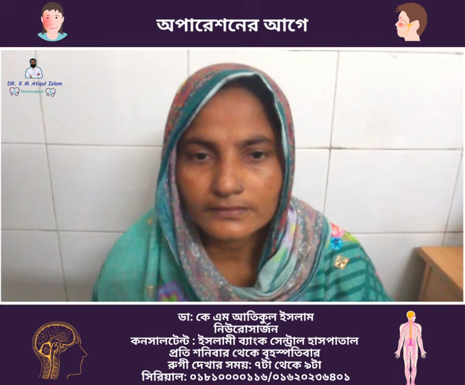 Arteriovenous Malformation (AVM) patient feedback