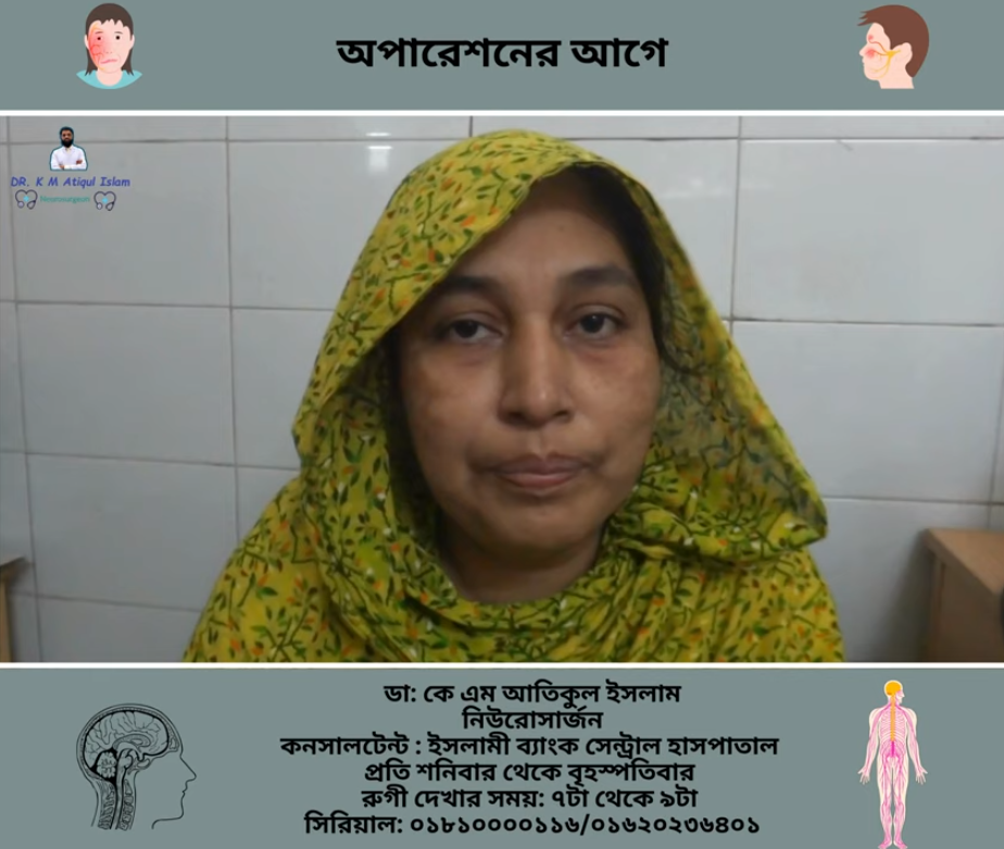 Brain Tumour Operation patient feedback