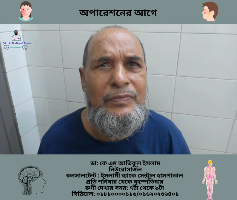 Minimally Invasive Spine Surgery patient feedback