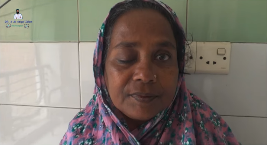 Clivus Chordoma patient recovery video